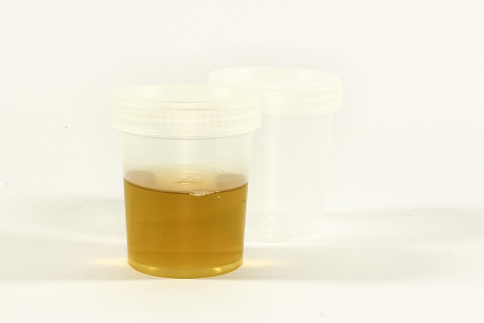 urine for drug test